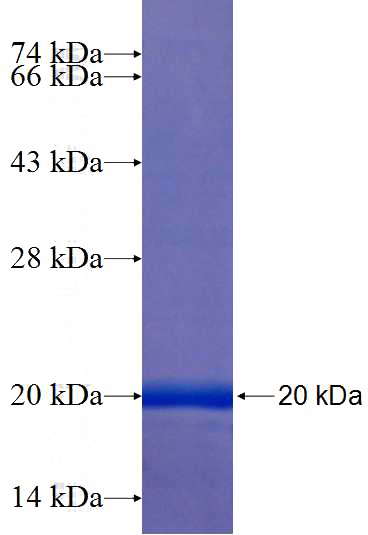 Recombinant Human Cyclin D1 SDS-PAGE