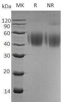 Human SLAMF1/SLAM (His tag) recombinant protein