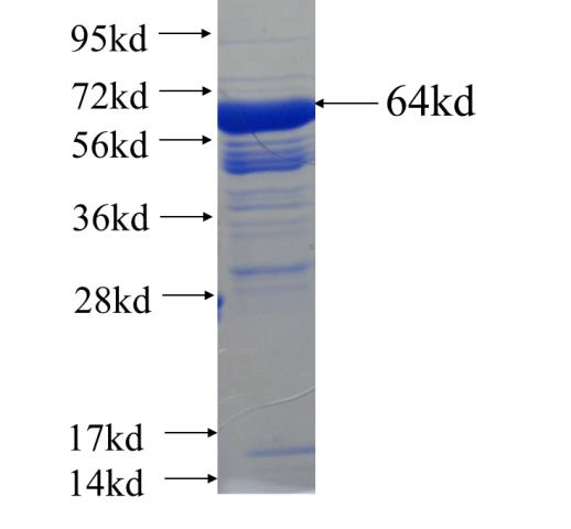 Recombinant human MAP2 SDS-PAGE