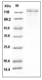 Human VLDLR / VLDL Receptor Protein (His Tag) SDS-PAGE