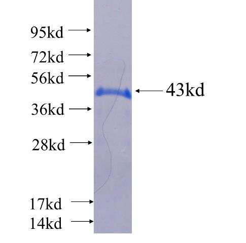 Recombinant human LMBRD2 SDS-PAGE