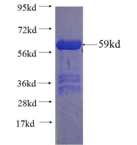 Recombinant human RXRG SDS-PAGE