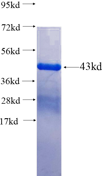 Recombinant Human KIF2A SDS-PAGE