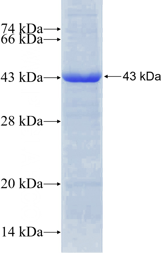 Recombinant Human RCL1 SDS-PAGE