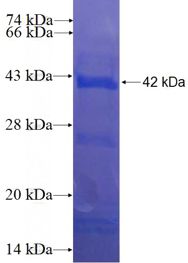 Recombinant Human CABLES1 SDS-PAGE