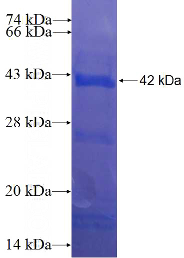 Recombinant Human CABLES1 SDS-PAGE