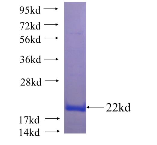 Recombinant human MTAP SDS-PAGE