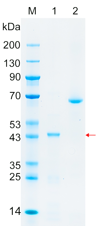 Recombinant WNK3 protein (His tag) SDS-PAGE