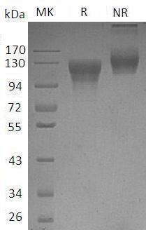 Human LEPR/DB/OBR (His tag) recombinant protein