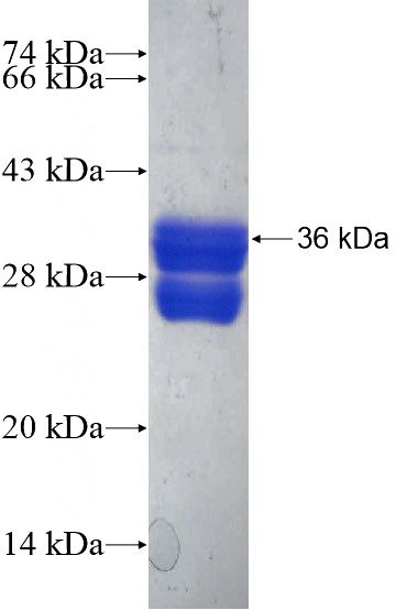 Recombinant Human SLC37A1 SDS-PAGE