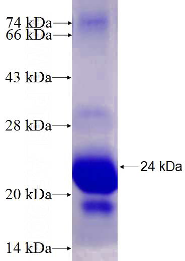 Recombinant Human PNPLA7 SDS-PAGE