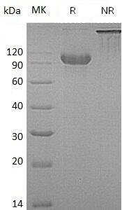 Human CDH16/UNQ695/PRO1340 (His tag) recombinant protein