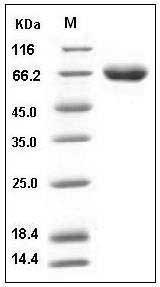 Mouse KIRREL1 / NEPH1 Protein (His Tag) SDS-PAGE