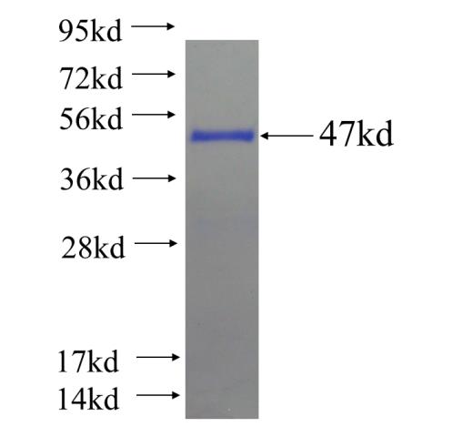 Recombinant human EXOSC1 SDS-PAGE