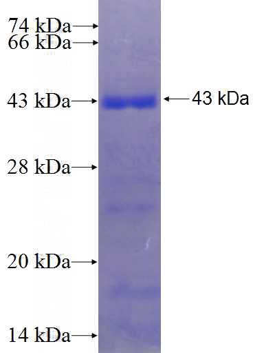 Recombinant Human PET112L SDS-PAGE
