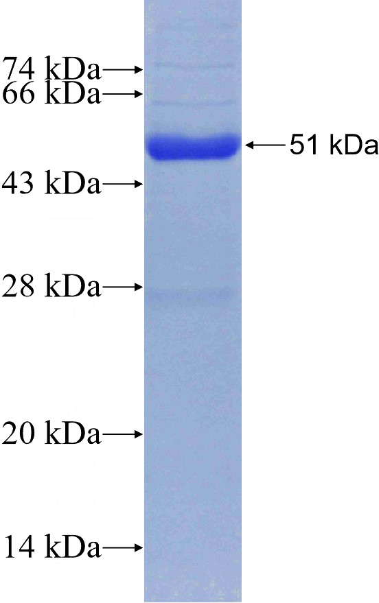 Recombinant Human PSMB6 SDS-PAGE