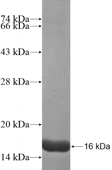 Recombinant Human DUPD1 SDS-PAGE