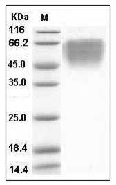 Human CD86/B7-2 (His Tag) recombinant protein