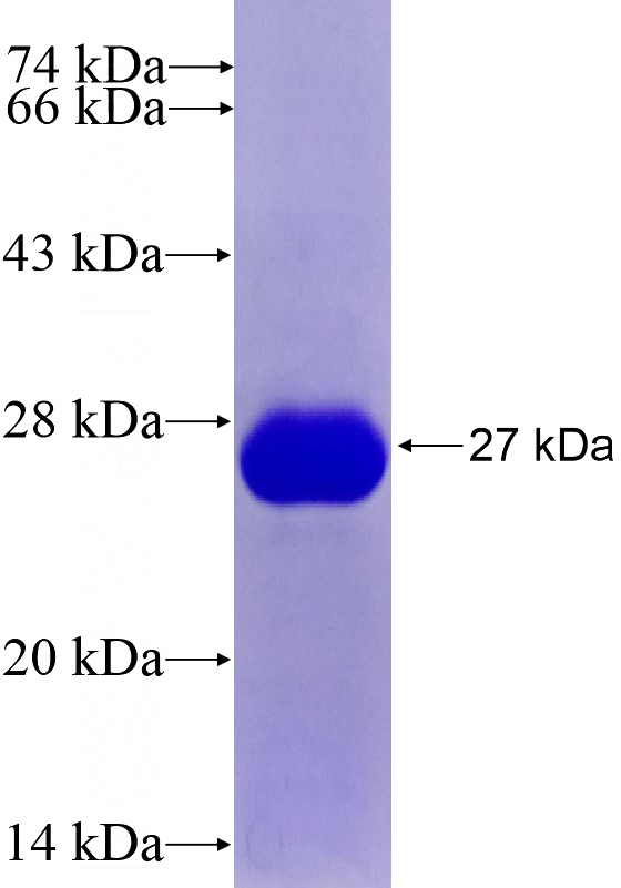 Recombinant Human CD11B SDS-PAGE