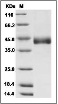 Human CHST11 / C4ST-1 Protein (His Tag) SDS-PAGE