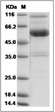 Rat Frizzled-4 / FZD4 Protein (Fc Tag) SDS-PAGE