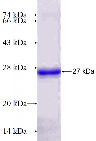 Recombinant Human CHRM1 SDS-PAGE