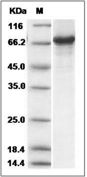 Human SRFBP1 Protein (His & GST Tag) SDS-PAGE