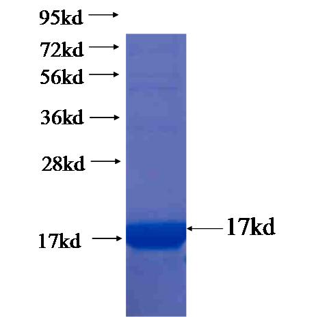 Recombinant human ZNF573 SDS-PAGE