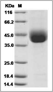 Mouse ANGPTL4 Protein (His Tag) SDS-PAGE