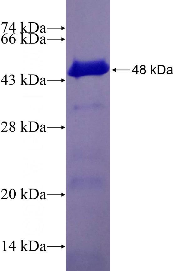 Recombinant Human HIRIP3 SDS-PAGE