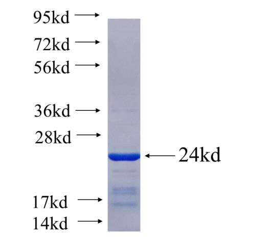 Recombinant human CSN3 SDS-PAGE