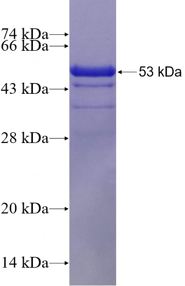Recombinant Human IRAK2 SDS-PAGE
