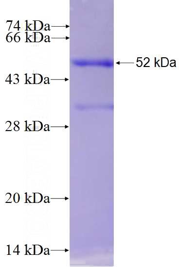 Recombinant Human DCHS1 SDS-PAGE