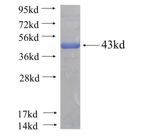 Recombinant human CLYBL(Full length) SDS-PAGE