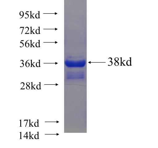 Recombinant human GJA5 SDS-PAGE
