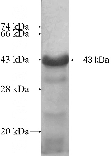 Recombinant Human TCEAL6 SDS-PAGE