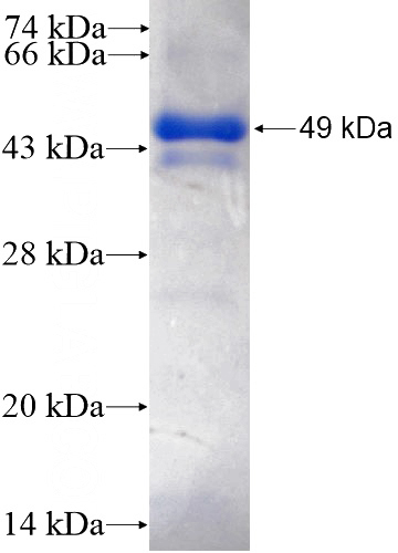 Recombinant Human HUWE1 SDS-PAGE