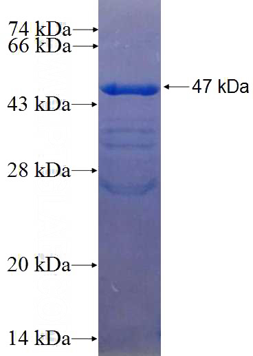 Recombinant Human LPIN1 SDS-PAGE
