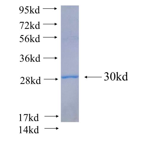Recombinant Arabidopsis thaliana SCAB1 SDS-PAGE