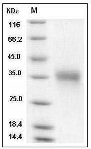 Human IGFBP6 / IBP-6 Protein (His Tag) SDS-PAGE