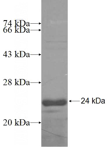 Recombinant Human RPS27A SDS-PAGE