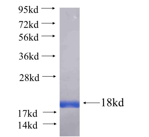 Recombinant human HAPLN3 SDS-PAGE