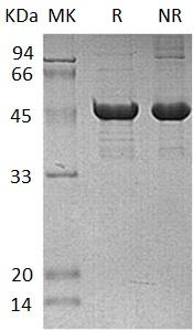 Human SCLY/SCL (His tag) recombinant protein