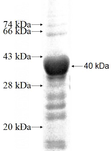 Recombinant Human CYP20A1 SDS-PAGE