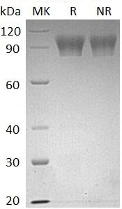 Human NLGN4X/KIAA1260/NLGN4/UNQ365 (His tag) recombinant protein