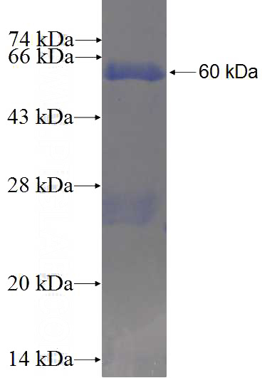 Recombinant Human LOXL1 SDS-PAGE