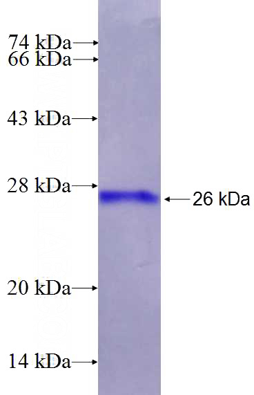 Recombinant Human RGS8 SDS-PAGE