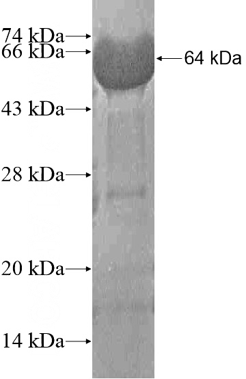 Recombinant Human PCDHGC5 SDS-PAGE