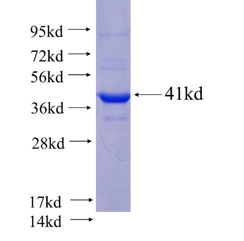 Recombinant human UGT1A6 SDS-PAGE