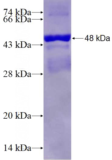 Recombinant Human RQCD1 SDS-PAGE